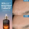 Advanced Night Repair Serum Synchronized Multi-Recovery ComplexReviews